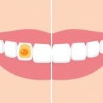 How to Properly Brush Your Teeth: Step-by-Step Guide