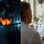 Impacted Wisdom Teeth: Symptoms, Causes & Treatment Guide