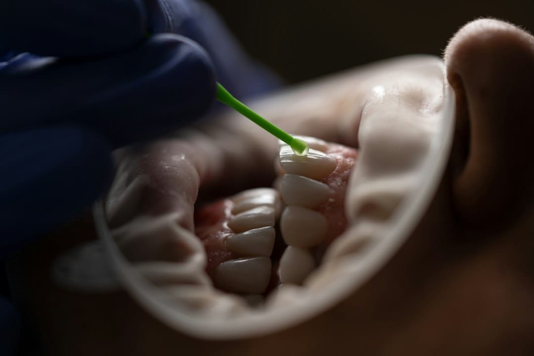 child dental examination for cavities