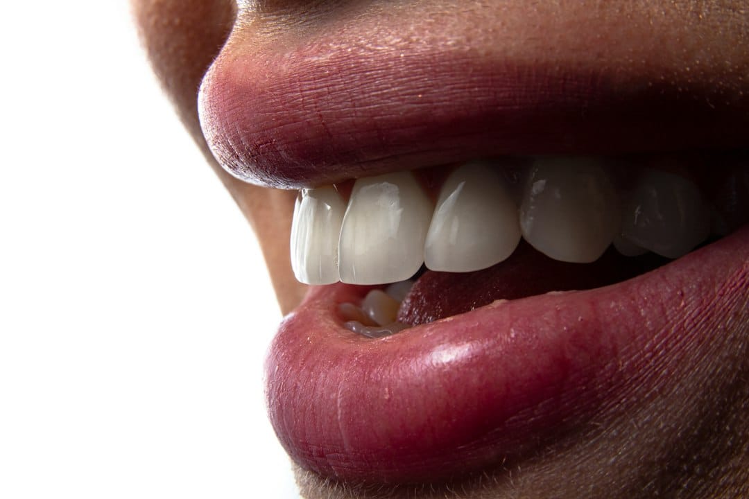 wisdom tooth pain dental examination